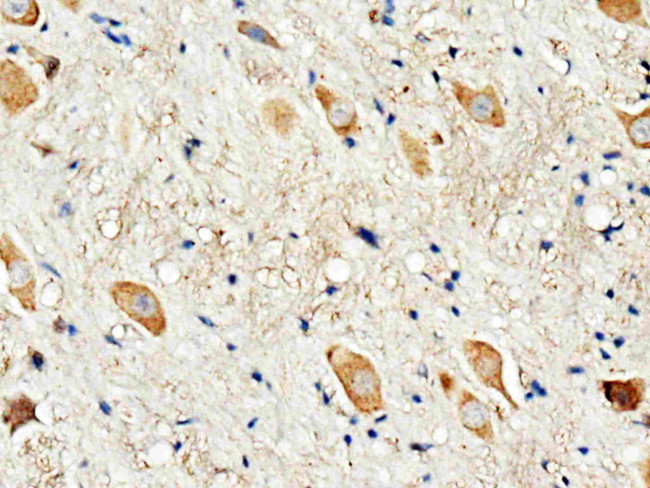 DRD3 Antibody in Immunohistochemistry (Paraffin) (IHC (P))