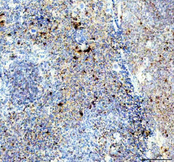 Neutrophil elastase Antibody in Immunohistochemistry (Paraffin) (IHC (P))
