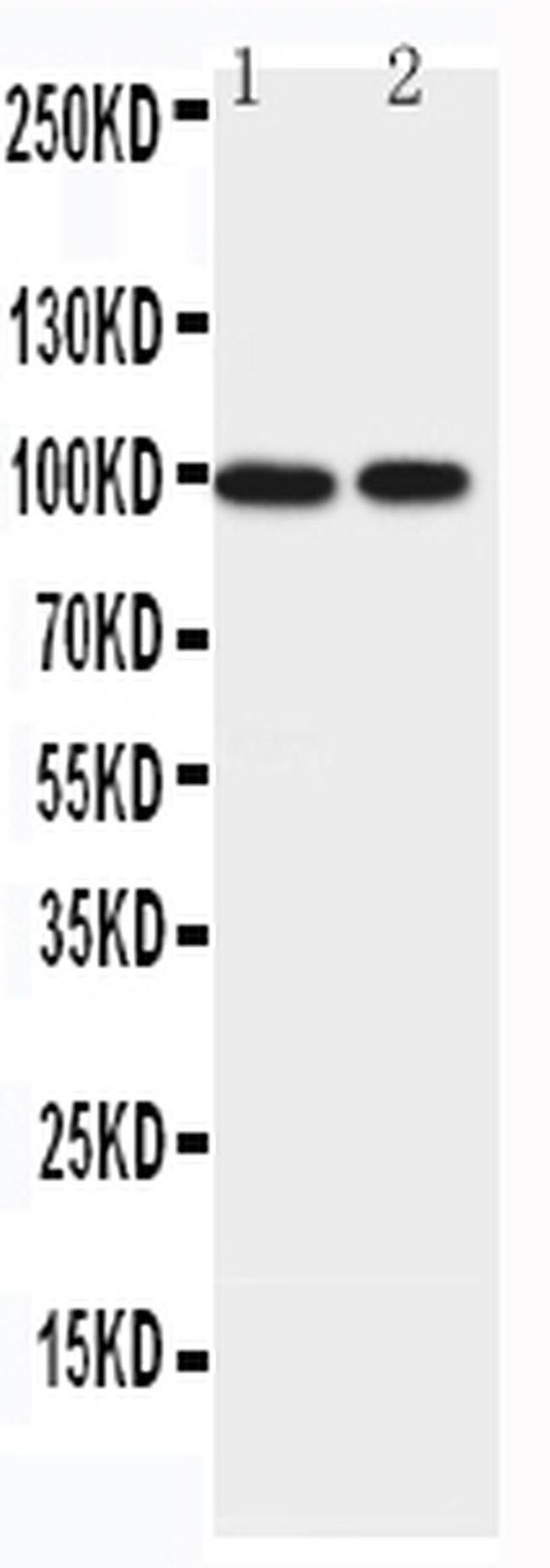 EPB41L1 Antibody in Western Blot (WB)
