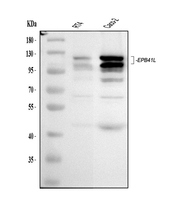 EPB41L1 Antibody in Western Blot (WB)