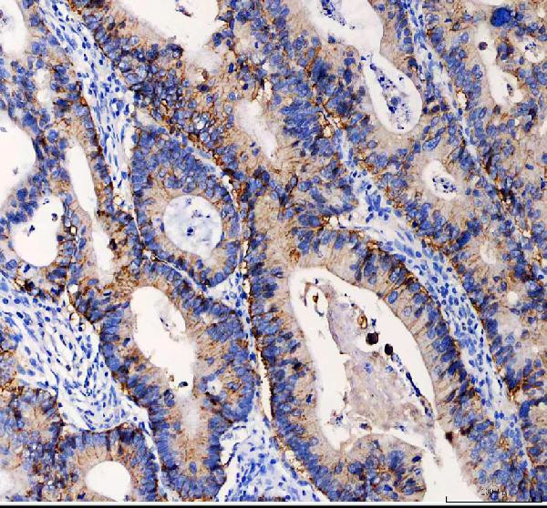 EpCAM (CD326) Antibody in Immunohistochemistry (Paraffin) (IHC (P))