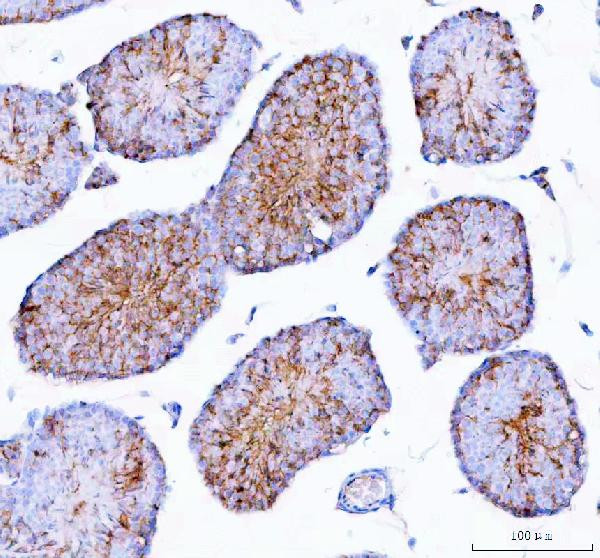 Epigen Antibody in Immunohistochemistry (Paraffin) (IHC (P))