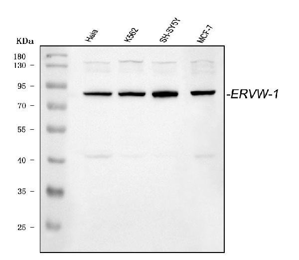 HERV Antibody in Western Blot (WB)