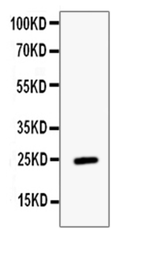 Endocan Antibody in Western Blot (WB)