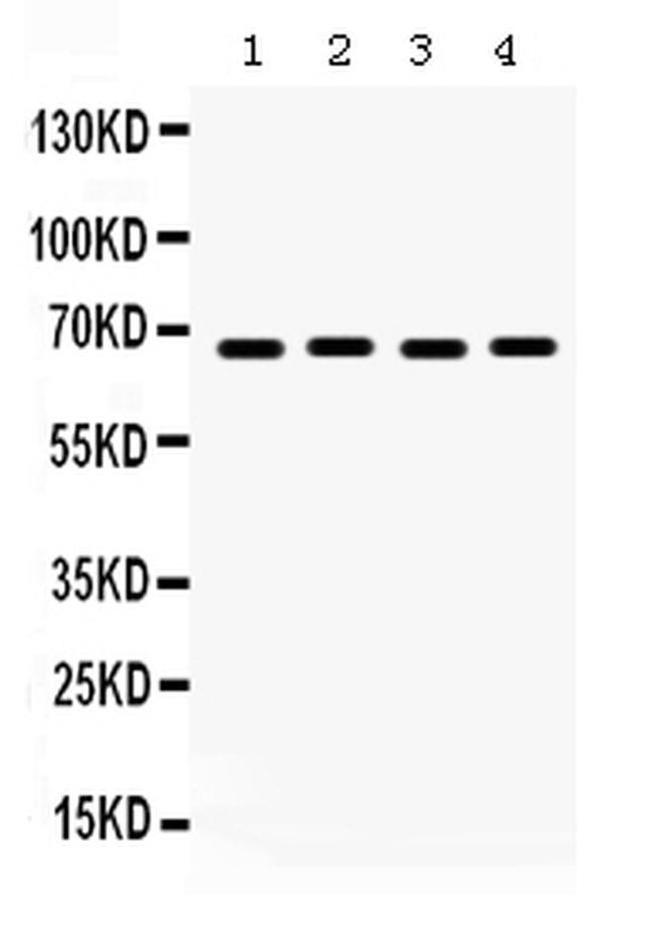 ETV4 Antibody in Western Blot (WB)