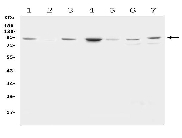 Factor VIII Antibody in Western Blot (WB)