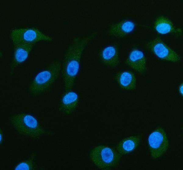 FABP5 Antibody in Immunocytochemistry (ICC/IF)