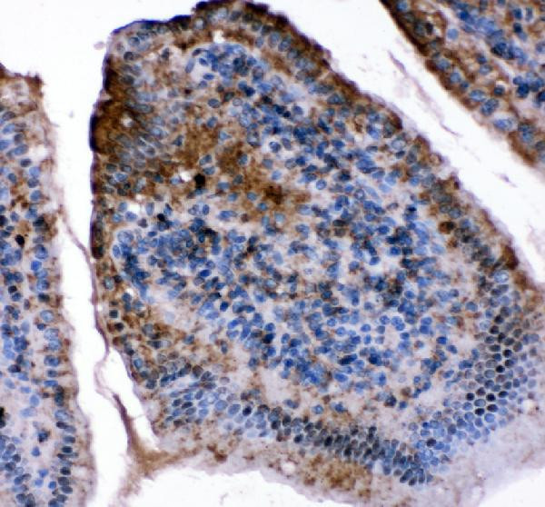 FABP5 Antibody in Immunohistochemistry (Paraffin) (IHC (P))
