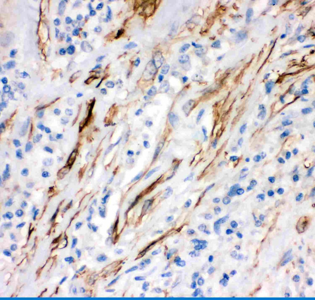FAS (CD95) Antibody in Immunohistochemistry (Paraffin) (IHC (P))