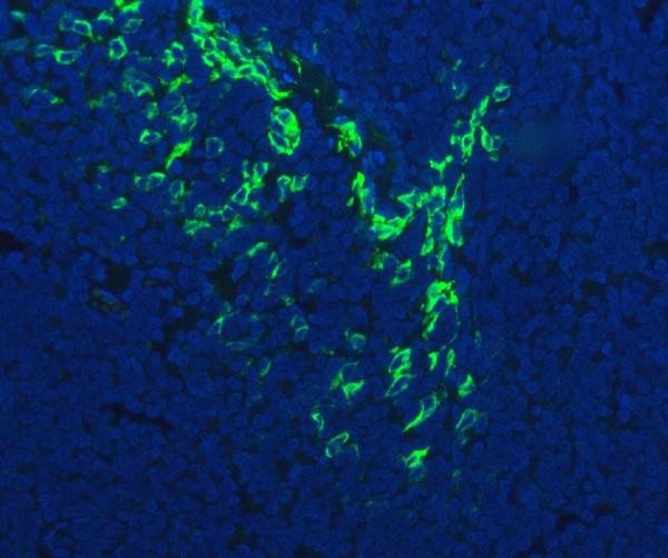 FDCSP Antibody in Immunohistochemistry (Paraffin) (IHC (P))