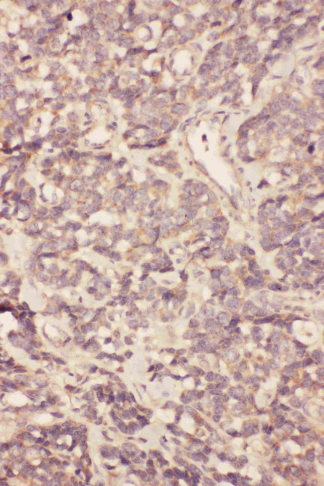 FGF19 Antibody in Immunohistochemistry (Paraffin) (IHC (P))