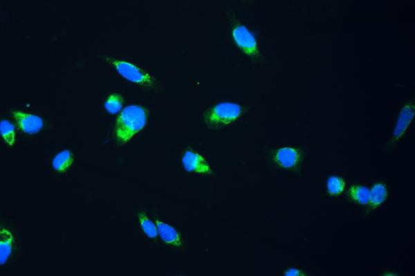 Fumarase Antibody in Immunocytochemistry (ICC/IF)