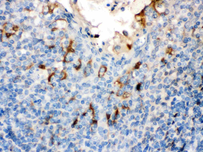 Filaggrin Antibody in Immunohistochemistry (Paraffin) (IHC (P))