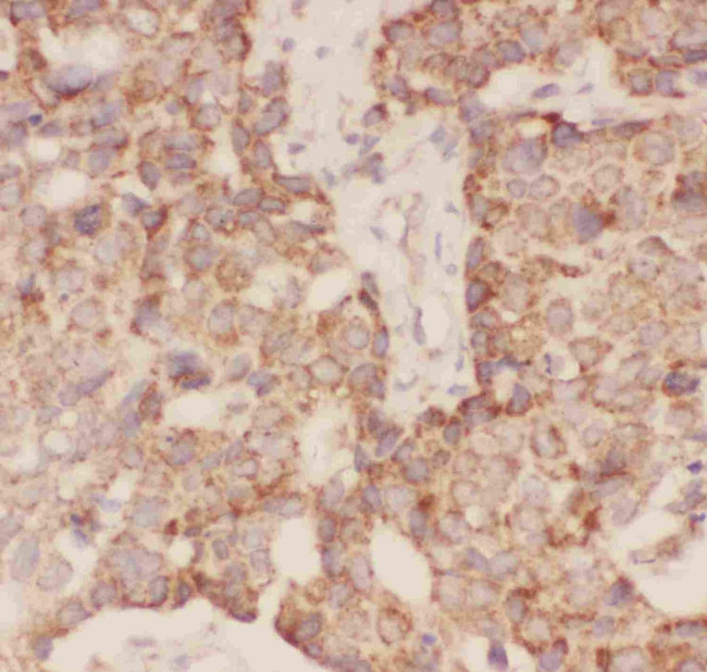 FSH beta Antibody in Immunohistochemistry (Paraffin) (IHC (P))