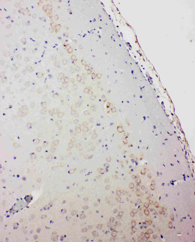 GABRA1 Antibody in Immunohistochemistry (Paraffin) (IHC (P))