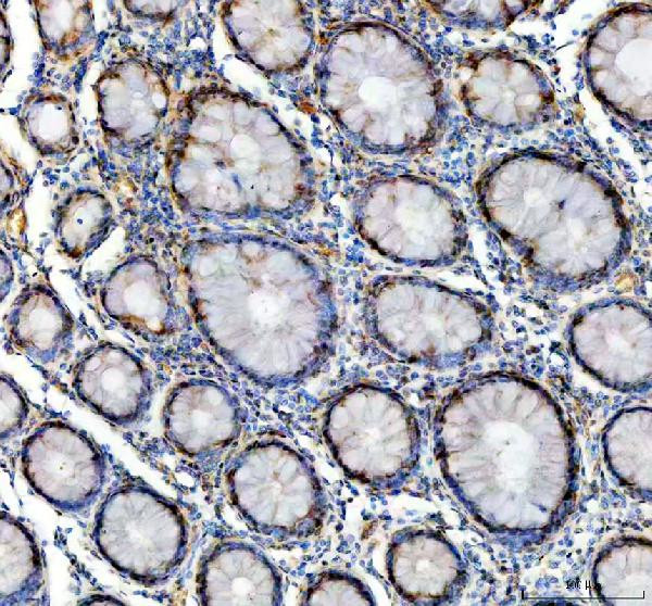 GALT Antibody in Immunohistochemistry (Paraffin) (IHC (P))