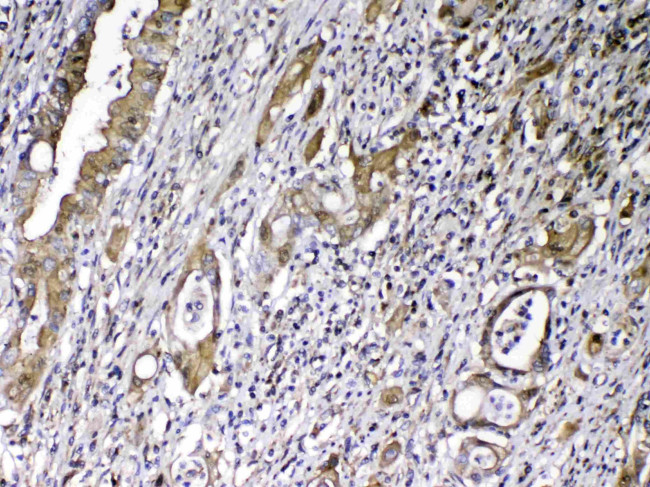 GC Antibody in Immunohistochemistry (Paraffin) (IHC (P))