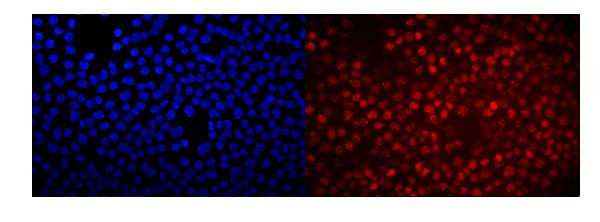 RACK1 Antibody in Immunocytochemistry (ICC/IF)