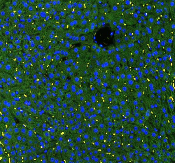 GSTA1/A2/A3/A4/A5 Antibody in Immunohistochemistry (Paraffin) (IHC (P))