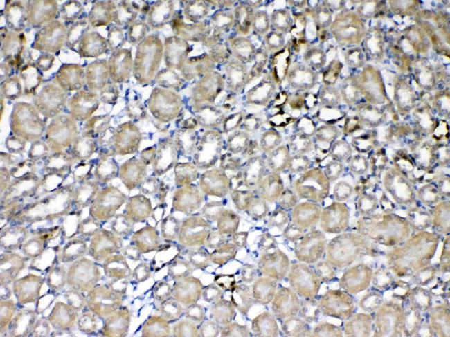 GSTP1 Antibody in Immunohistochemistry (Paraffin) (IHC (P))