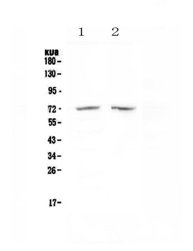 HDAC10 Antibody in Western Blot (WB)