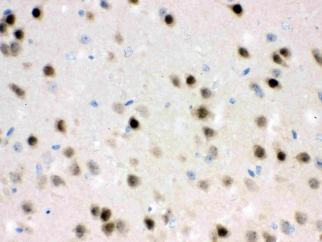 HDAC11 Antibody in Immunohistochemistry (Paraffin) (IHC (P))