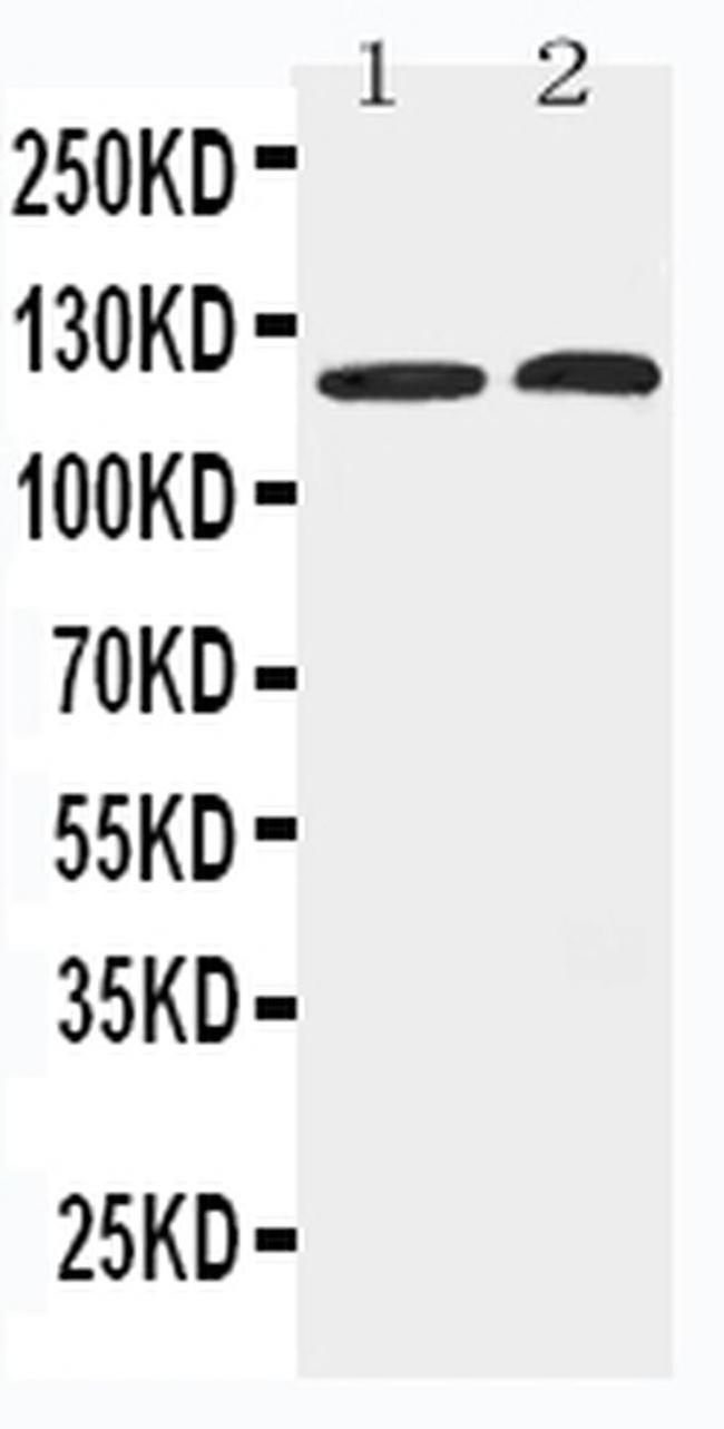 HDAC5 Antibody in Western Blot (WB)