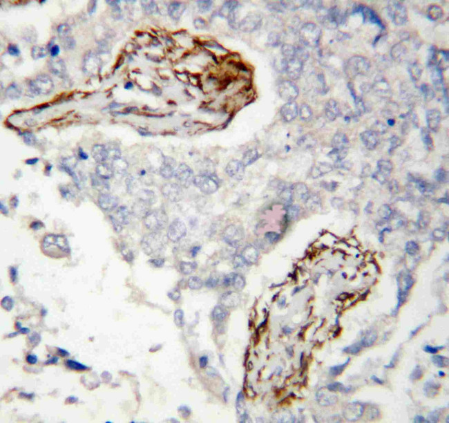 HDAC8 Antibody in Immunohistochemistry (Paraffin) (IHC (P))