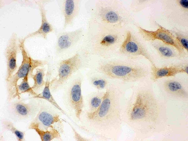 HLA-C Antibody in Immunocytochemistry (ICC/IF)