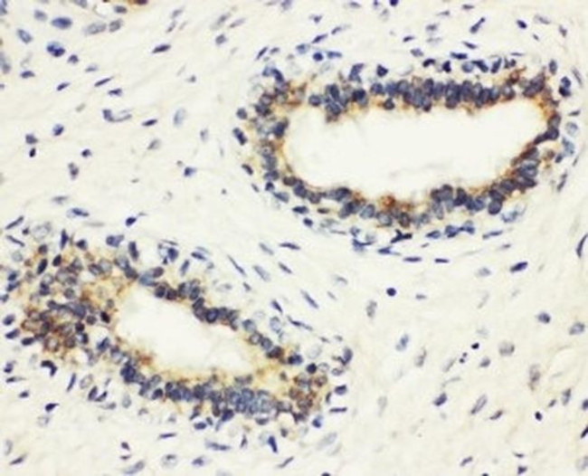 HLA-DMB Antibody in Immunohistochemistry (Paraffin) (IHC (P))