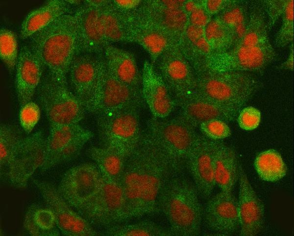HLTF Antibody in Immunocytochemistry (ICC/IF)