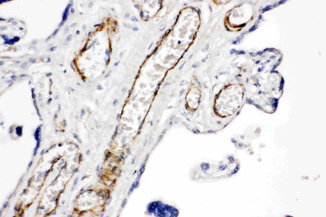 RHAMM Antibody in Immunohistochemistry (Paraffin) (IHC (P))
