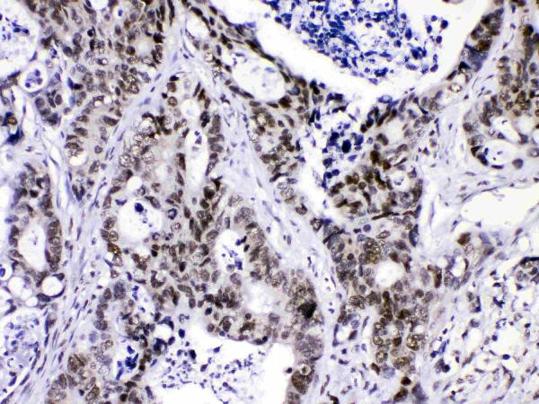 hnRNP F Antibody in Immunohistochemistry (Paraffin) (IHC (P))