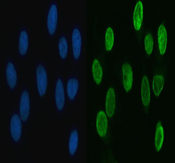 hnRNP L Antibody in Immunocytochemistry (ICC/IF)
