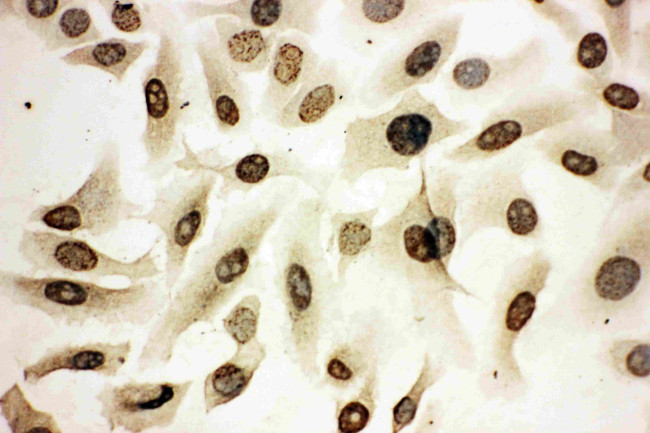 HOXA4 Antibody in Immunocytochemistry (ICC/IF)