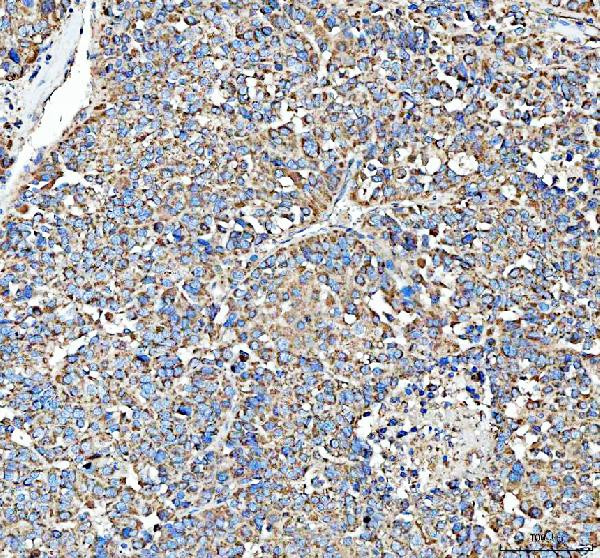 HSD11B1 Antibody in Immunohistochemistry (Paraffin) (IHC (P))