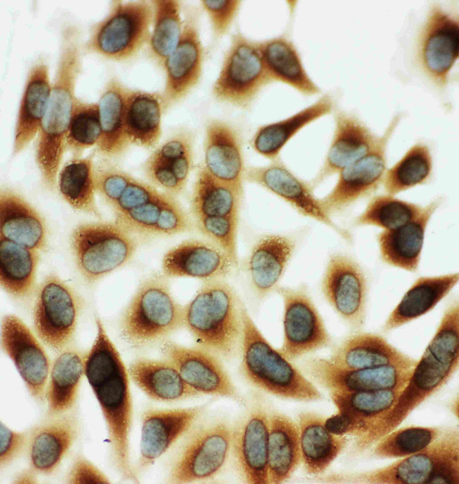 HSPB2 Antibody in Immunocytochemistry (ICC/IF)