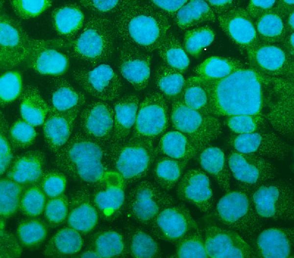 ICAM-1 (CD54) Antibody in Immunocytochemistry (ICC/IF)
