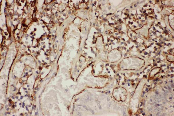 ICAM-1 (CD54) Antibody in Immunohistochemistry (Paraffin) (IHC (P))
