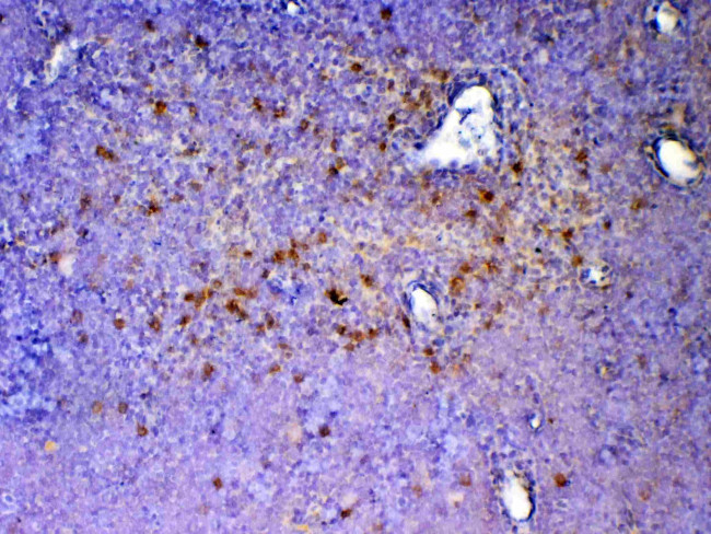 ICOS (CD278) Antibody in Immunohistochemistry (Paraffin) (IHC (P))