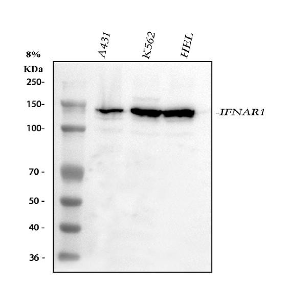 IFNAR1 Antibody in Western Blot (WB)