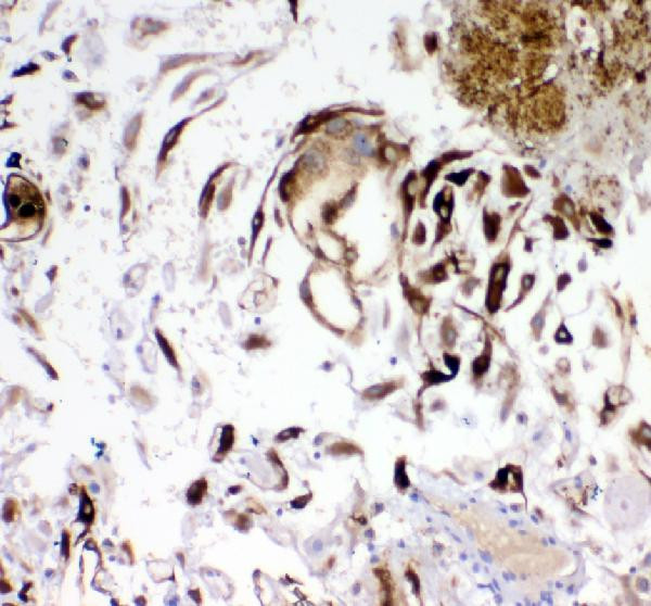 IGFBP-1 Antibody in Immunohistochemistry (Paraffin) (IHC (P))