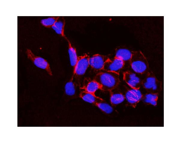 IKK beta Antibody in Immunocytochemistry (ICC/IF)
