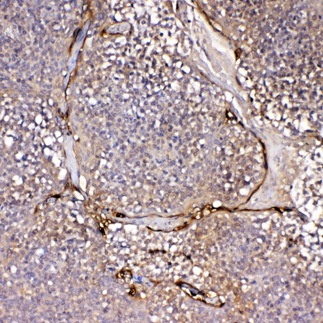 IL1F10 Antibody in Immunohistochemistry (Paraffin) (IHC (P))