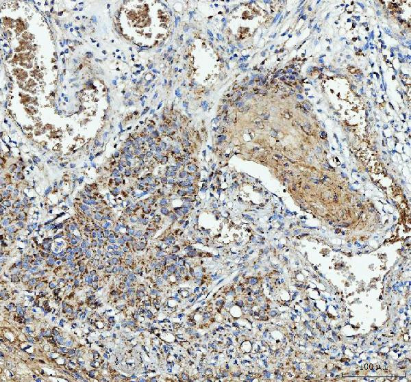 IL1RA Antibody in Immunohistochemistry (Paraffin) (IHC (P))