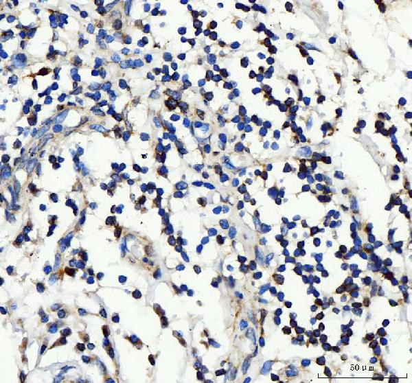 CD25 Antibody in Immunohistochemistry (Paraffin) (IHC (P))