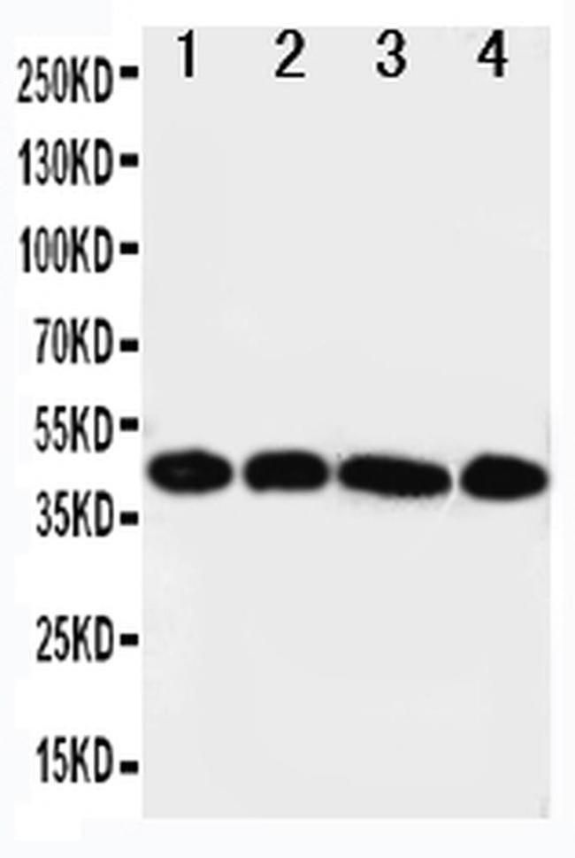 CD123 Antibody in Western Blot (WB)