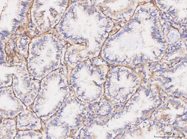 CD49a (Integrin alpha 1) Antibody in Immunohistochemistry (Paraffin) (IHC (P))
