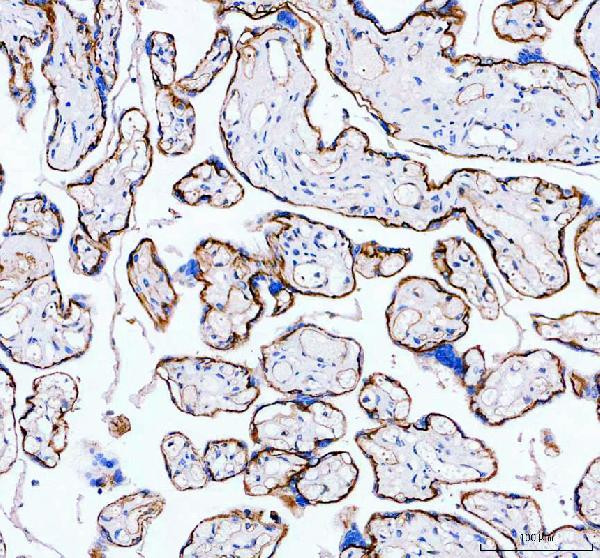 CD49e (Integrin alpha 5) Antibody in Immunohistochemistry (Paraffin) (IHC (P))