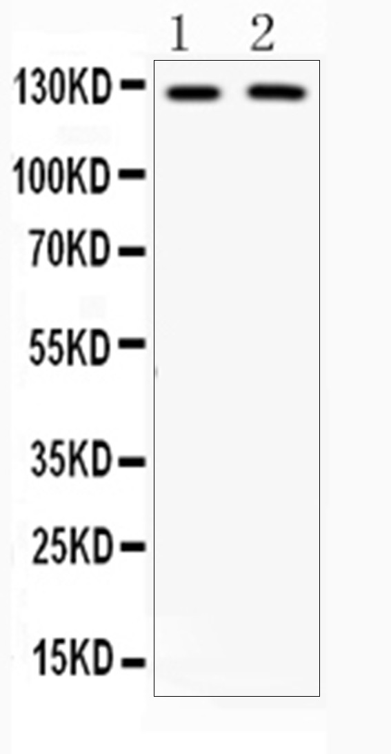 CD11b Antibody in Western Blot (WB)